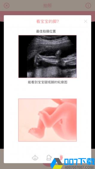 胎儿相机app下载_胎儿相机app最新版免费下载